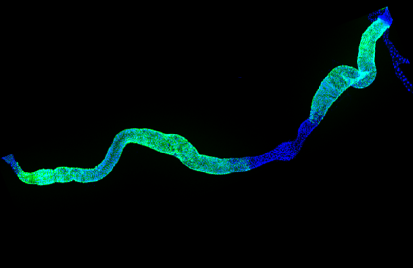 Fruit fly gut cells glow green and blue in a microscopy image against a dark background