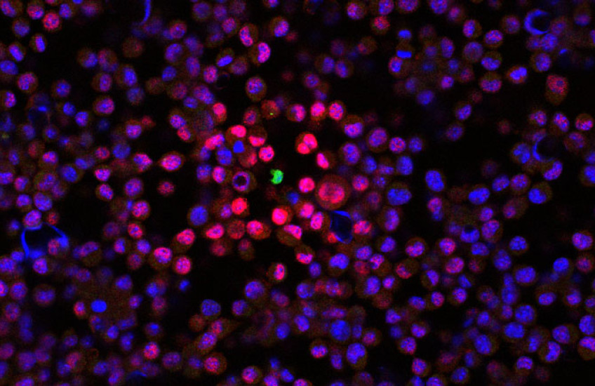 A single green dot in the center of many pink and purple dots