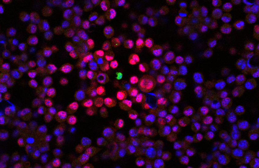 A single green dot in the center of many pink and purple dots