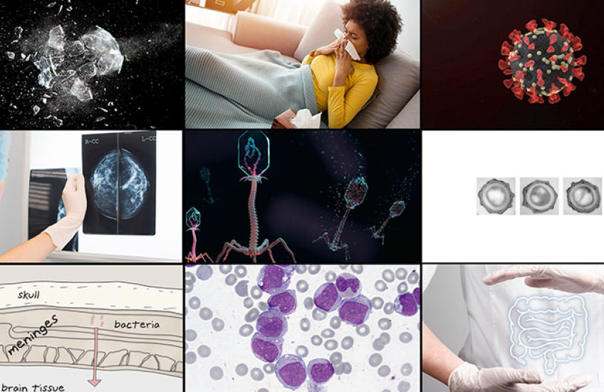 A grid of nine images, including breaking glass, a woman blowing her nose, a SARS-CoV-2 particle, illustration of phage viruses, microscopy images of bacterial spores, and an illustration of the meninges