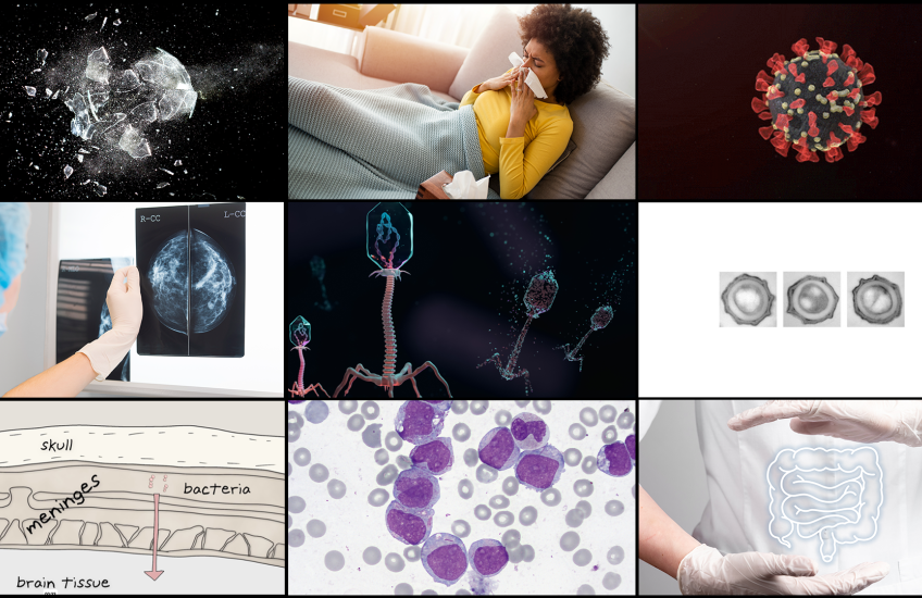 A grid of nine images, including breaking glass, a woman blowing her nose, a SARS-CoV-2 particle, illustration of phage viruses, microscopy images of bacterial spores, and an illustration of the meninges