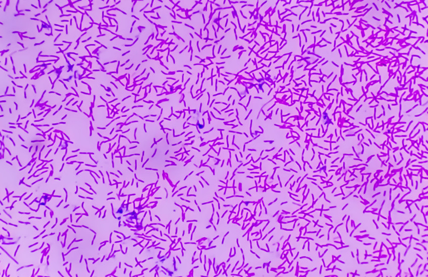 Hundreds of rod-shaped bacteria, colorized magenta, strewn across a pink background