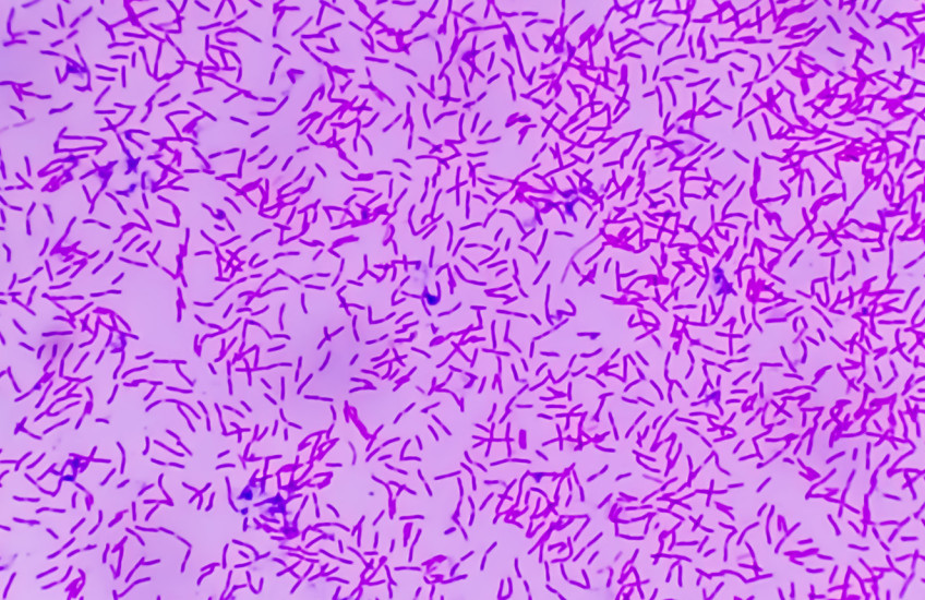 Hundreds of rod-shaped bacteria, colorized magenta, strewn across a pink background