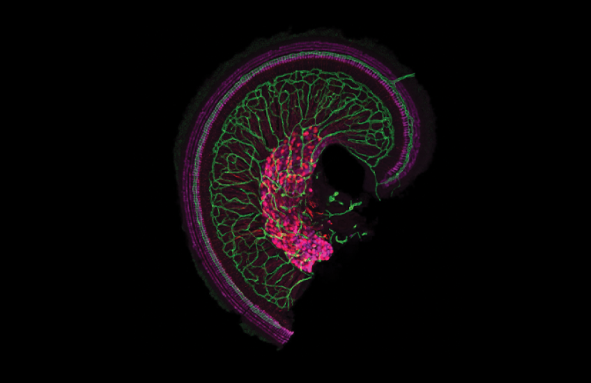 The apex of the snail-shaped cochlea with dense vascular network shown in green, as well as hair cells and cell bodies and axons of auditory neurons shown in magenta.