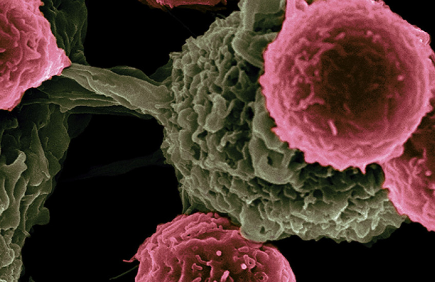 Microscopy image of four spheres (T cells) in front of a large structure with a sphere connected to a main body by a stalk(dendritic cell)