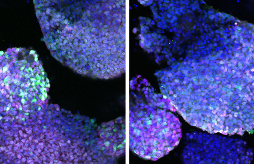 Two side-by-side microscopic images show purple blobs with individual cell nuclei glowing in shades of blue, green, and pink
