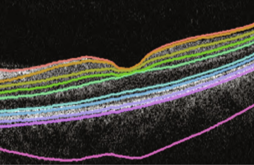 Different colored lines showing thickness layers on a black background