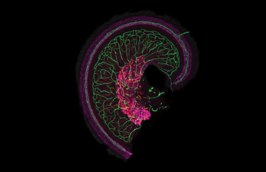 The apex of the snail-shaped cochlea with dense vascular network shown in green, as well as hair cells and cell bodies and axons of auditory neurons shown in magenta.