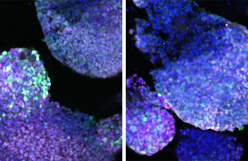 Two side-by-side microscopic images show purple blobs with individual cell nuclei glowing in shades of blue, green, and pink