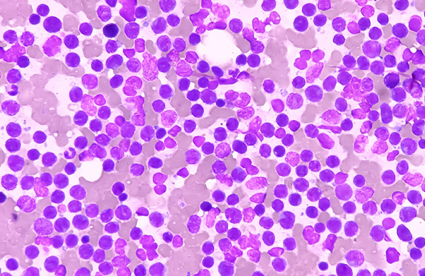 Blood cells are stained various shades of pink and purple and appear as clusters of circles under a microscope