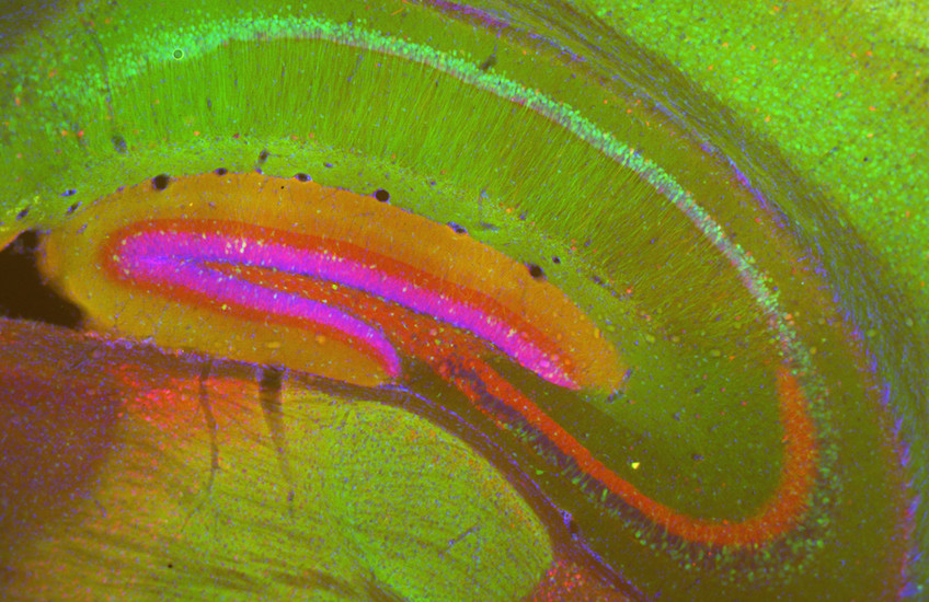 colored cross-section of the hippocampus of a mouse shows several folds one on top of the other