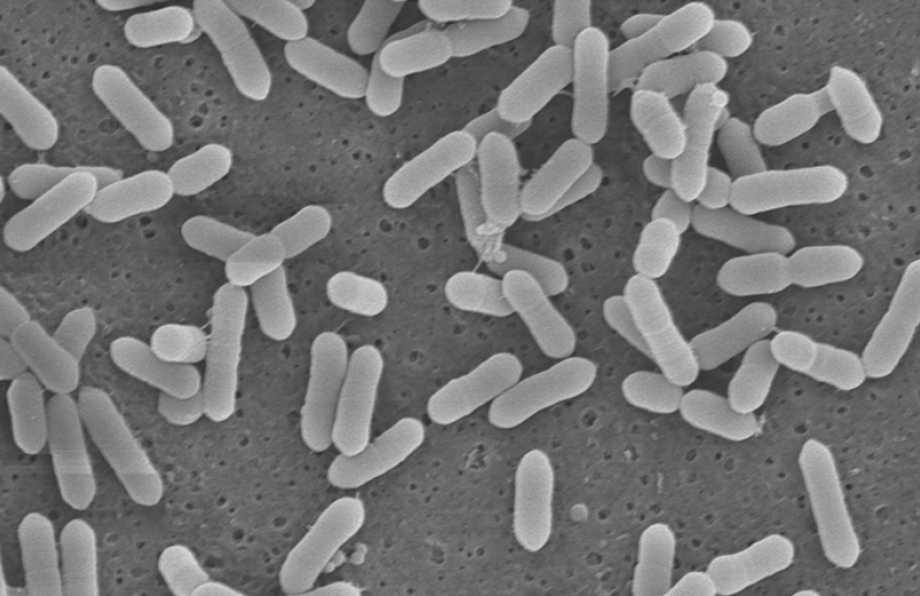 microscope image of dozens of rod-shaped bacteria