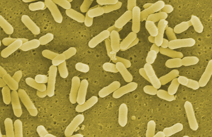 Colorized microscope image shows a collection of rod-shaped bacteria