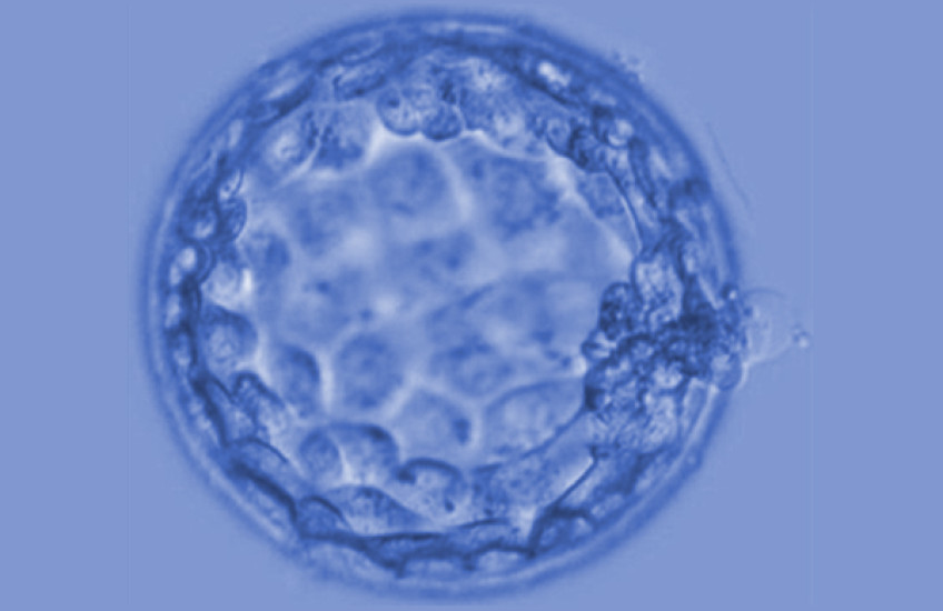 microscope image of a spherical blastocyst--membrane enclosing a few cells that form an early embryo