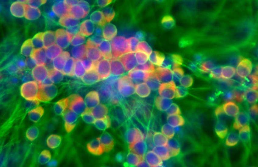 microscope image shows rainbow-tinted tubular cells connected by a network of filaments