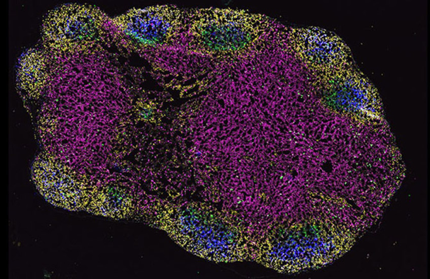 different cell types are fluorescently tagged different colors in a blob-shaped lymph node seen under a microscope
