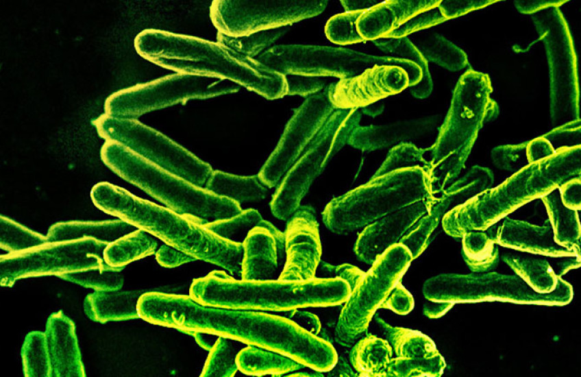Rod-shaped Mycobacterium tuberculosis, the bacterium that causes TB, glowing green against a dark background in a scanning electron micrograph.