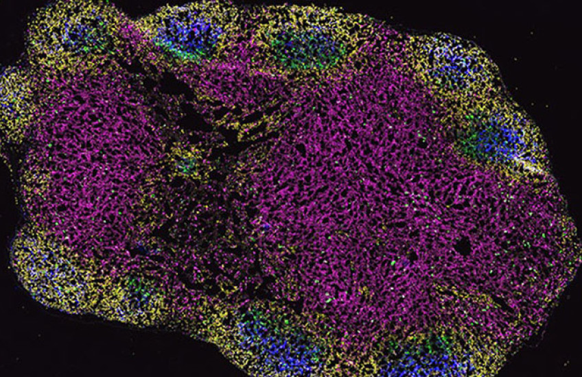 different cell types are fluorescently tagged different colors in a blob-shaped lymph node seen under a microscope