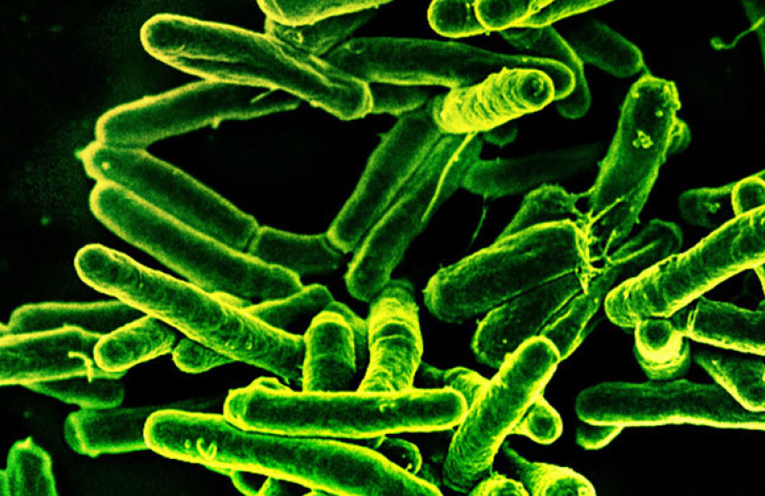 Rod-shaped Mycobacterium tuberculosis, the bacterium that causes TB, glowing green against a dark background in a scanning electron micrograph.