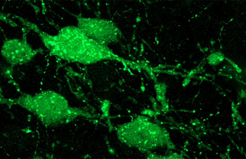 microscopy image shows blobs of cell bodies with sparkling green