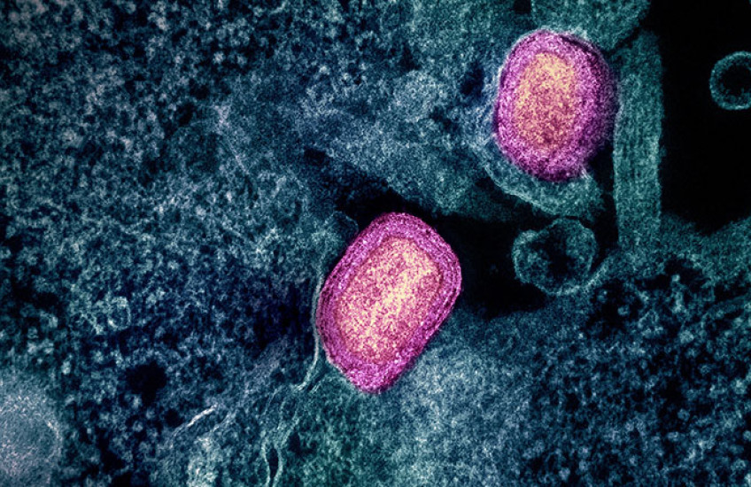 Colorized scanning electron micrograph shows two bright ovals against a webby cell-surface backdrop