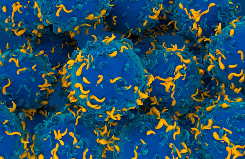 Many large blue spheres covered in short, thin, blue and yellow tendrils