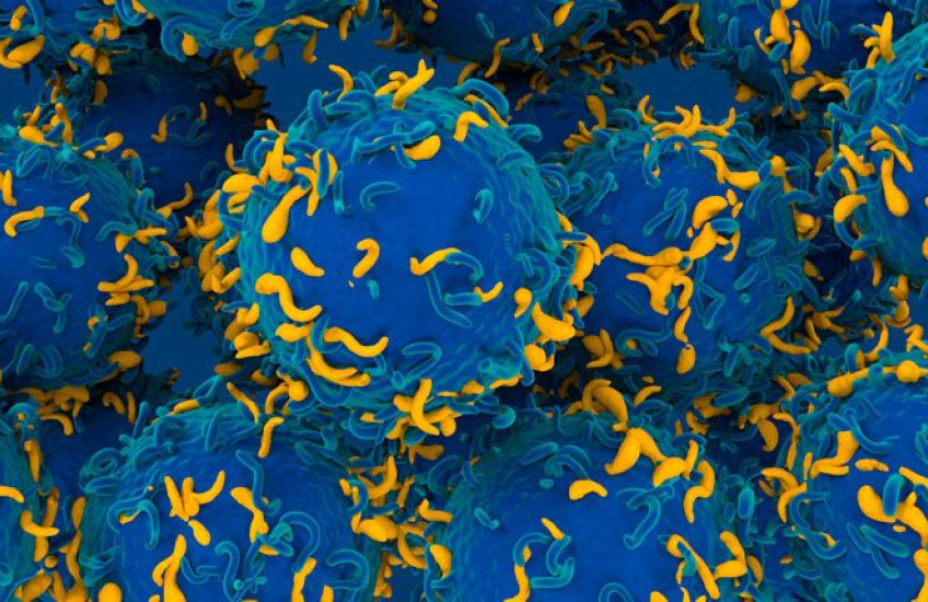 Many large blue spheres covered in short, thin, blue and yellow tendrils