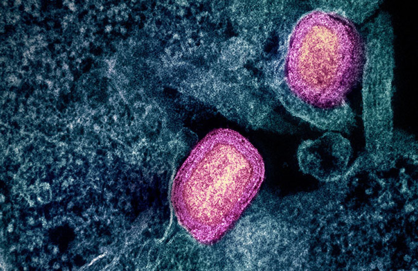 Colorized scanning electron micrograph shows two bright ovals against a webby cell-surface backdrop