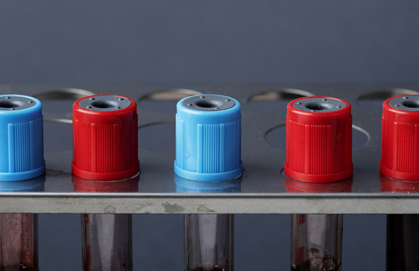 close-up, side-on photograph of blood vials in a rack with different colored caps