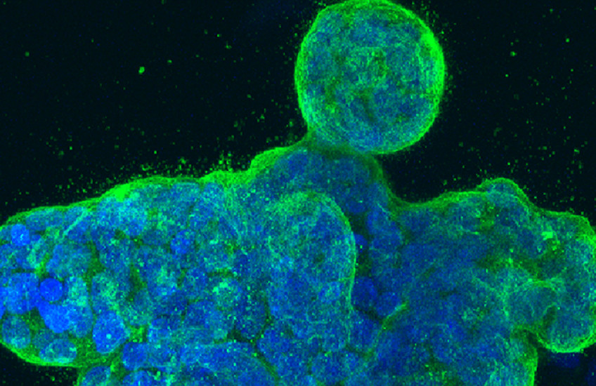 a blobby cluster of cancer cells glows blue with green edges under a microscope