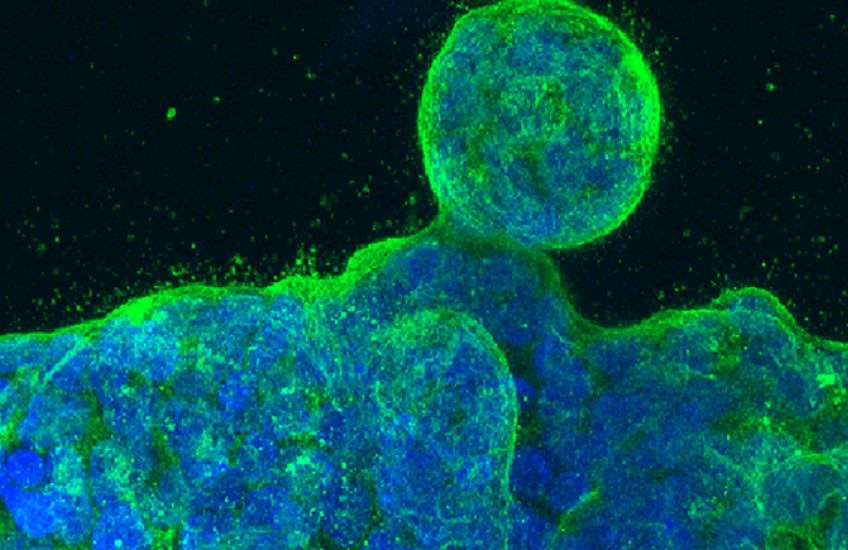 a blobby cluster of cancer cells glows blue with green edges under a microscope