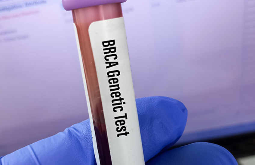 A vial of blood labeled BRCA genetic test