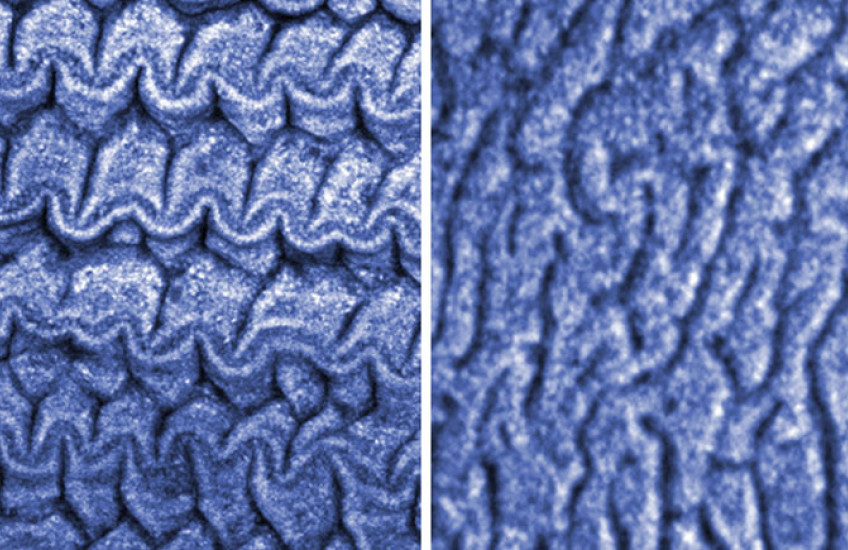 Side-by-side images show different patterns under a microscope. One is more condensed and crinkled in rows, while the other has flatter whorls like the surface of a brain.