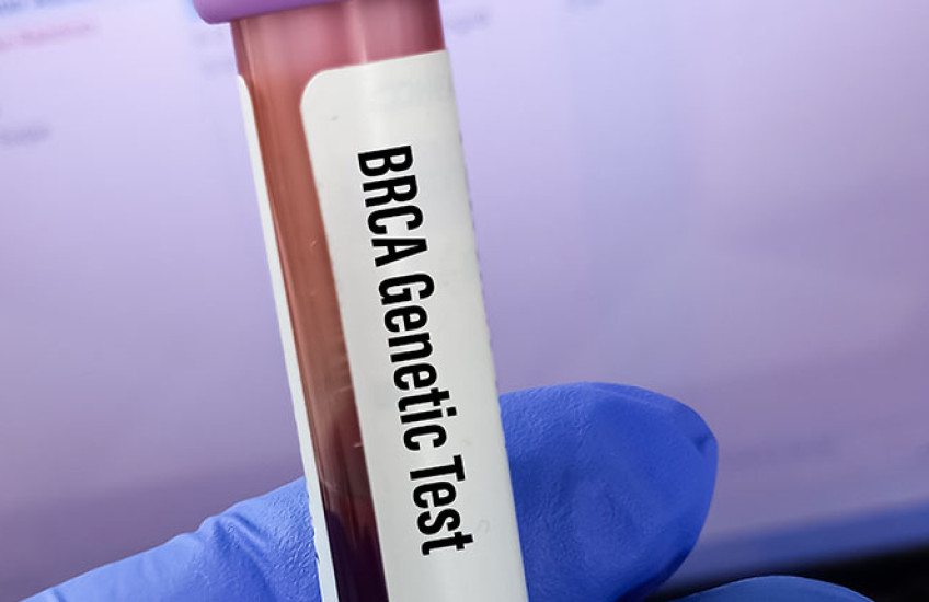 A vial of blood labeled BRCA genetic test