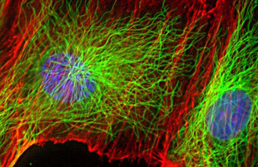 Microscope image of fluorescent human cells