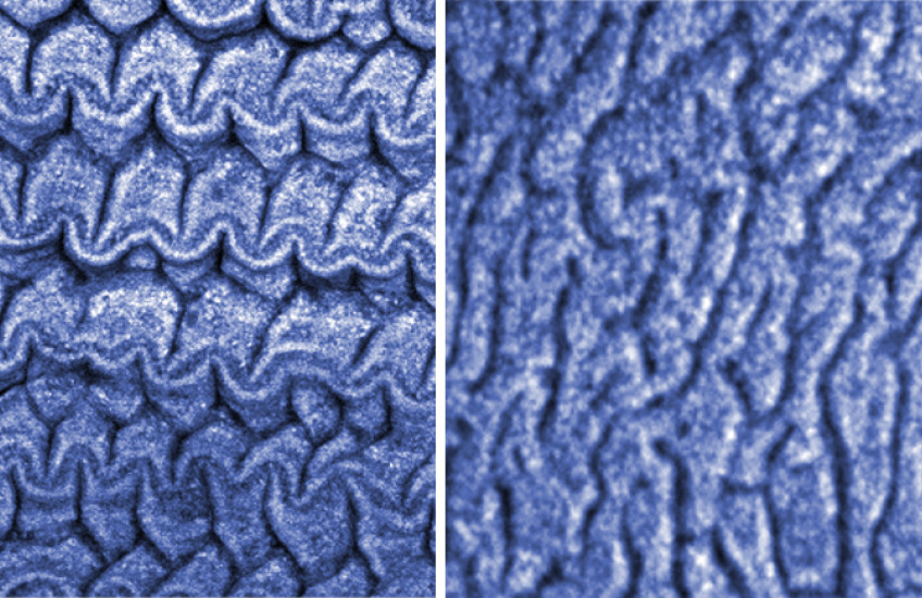 Side-by-side images show different patterns under a microscope. One is more condensed and crinkled in rows, while the other has flatter whorls like the surface of a brain.