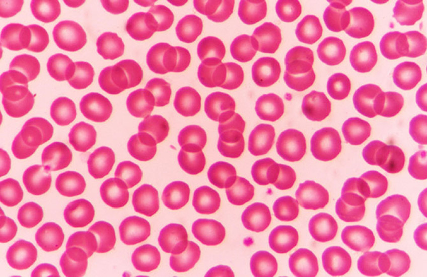 Red blood cells appear as dozens of spheres under a microscope