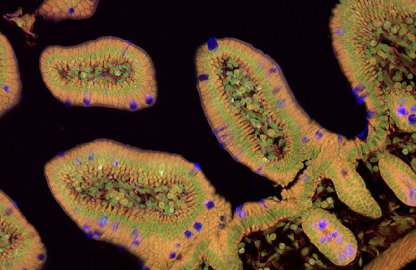 A cross-section of intestinal lining appears like irregular ovals with complex cell structures, shown in brown with green rings and occasional purple cells
