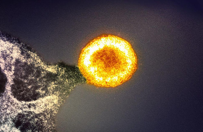 A bright circular virus particle shines in the center of an image against a dark background, with the edge of an infected cell seen in one corner.