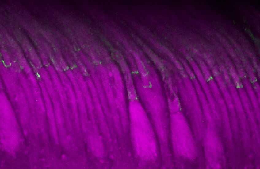 Cells in a row under a microscope have wider bases and long tails bending slightly to the left like reeds in a breeze. Each cell is fluorescently tagged purple with a dot of green about halfway up.