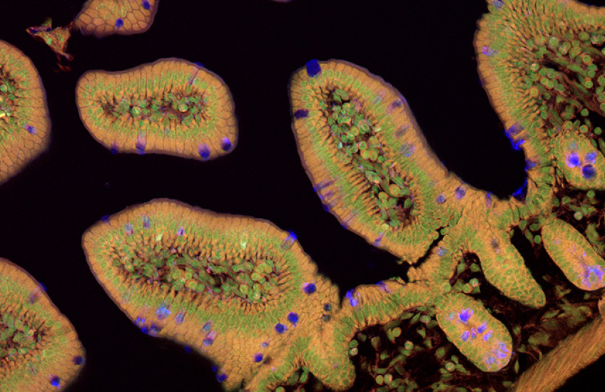 A cross-section of intestinal lining appears like irregular ovals with complex cell structures, shown in brown with green rings and occasional purple cells