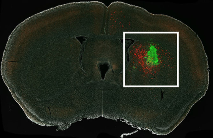 Cross-section of a mouse brain under a microscope shows a cluster of glioma cells tagged in green and connected neurons shown in red, concentrated around the glioma but also stretching from other areas of the brain.