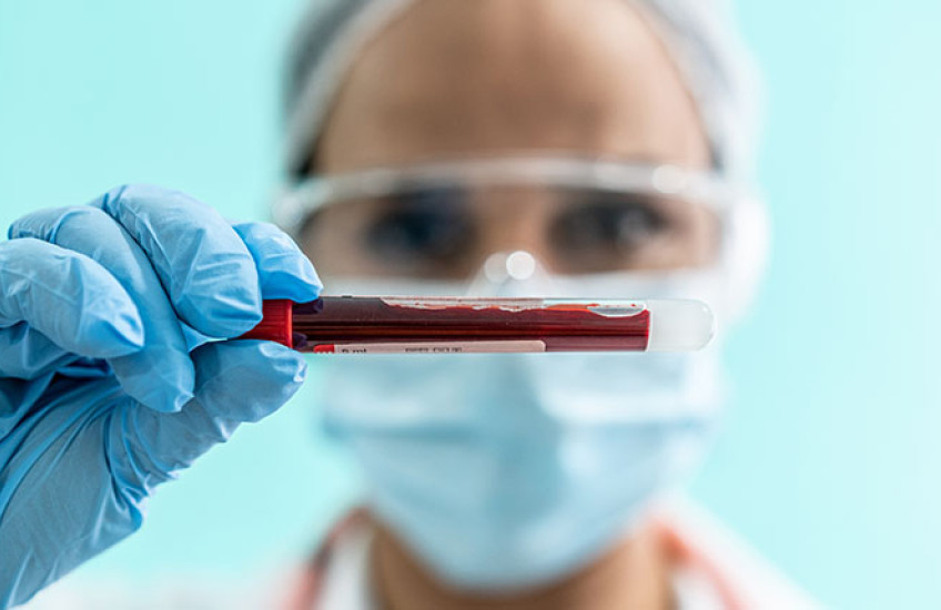 A person wearing protective gloves, glasses, and mask holds a small vial containing a blood sample.