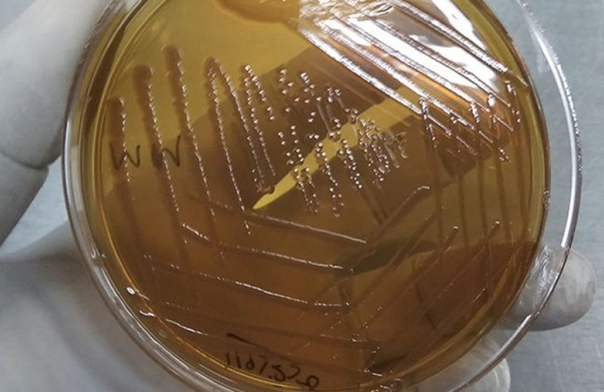 A gloved hand holds a Petri dish with bacteria growing in it