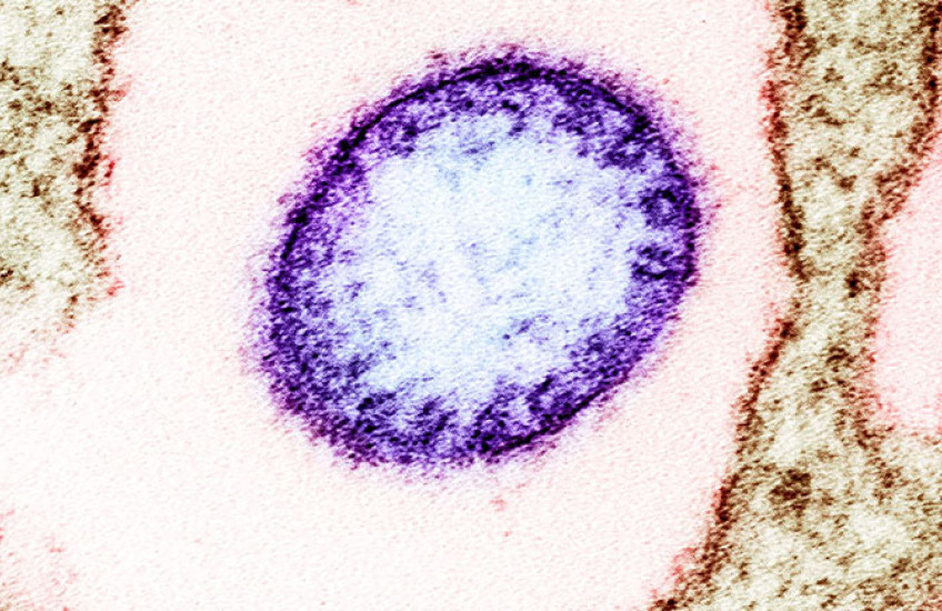 A purple circular Nipah virus particle floats in a field of pink surrounded by brown VERO cells.