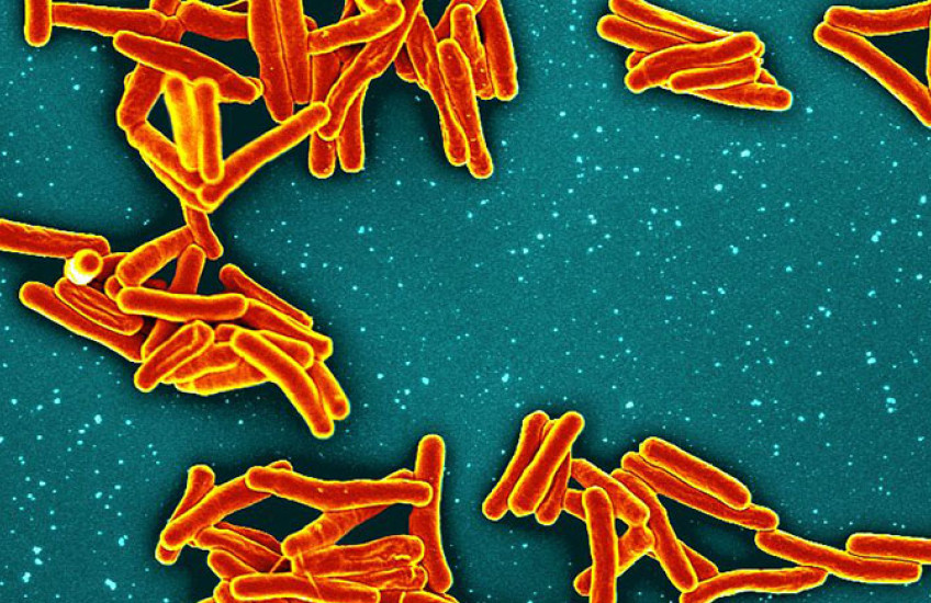 The germs that cause tuberculosis appear as clumps of red and yellow rod-shaped particles on a jade-green background.