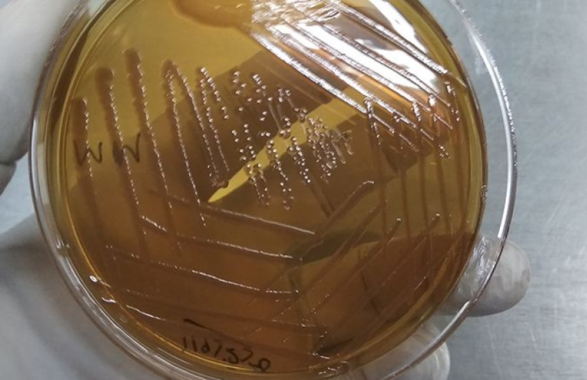 A gloved hand holds a Petri dish with bacteria growing in it
