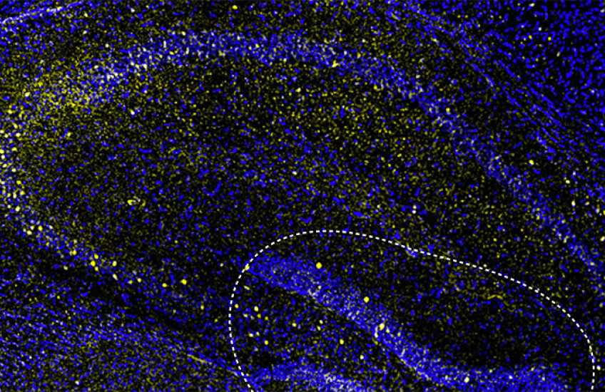 microscope image shows blue swirls with clusters of yellow dots against a black background