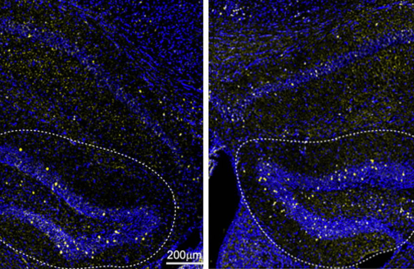 side-by-side microscope images show blue swirls with clusters of yellow dots against a black background