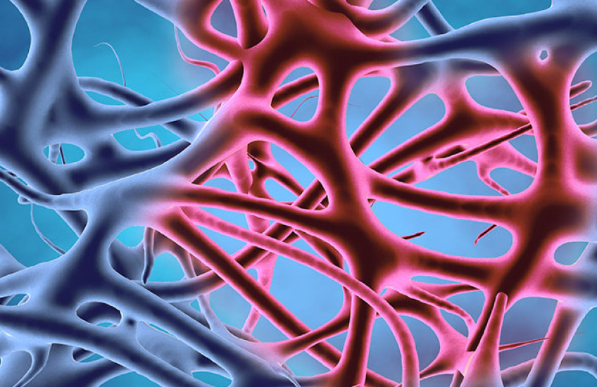 A close-up of inflamed tissue under a microscope